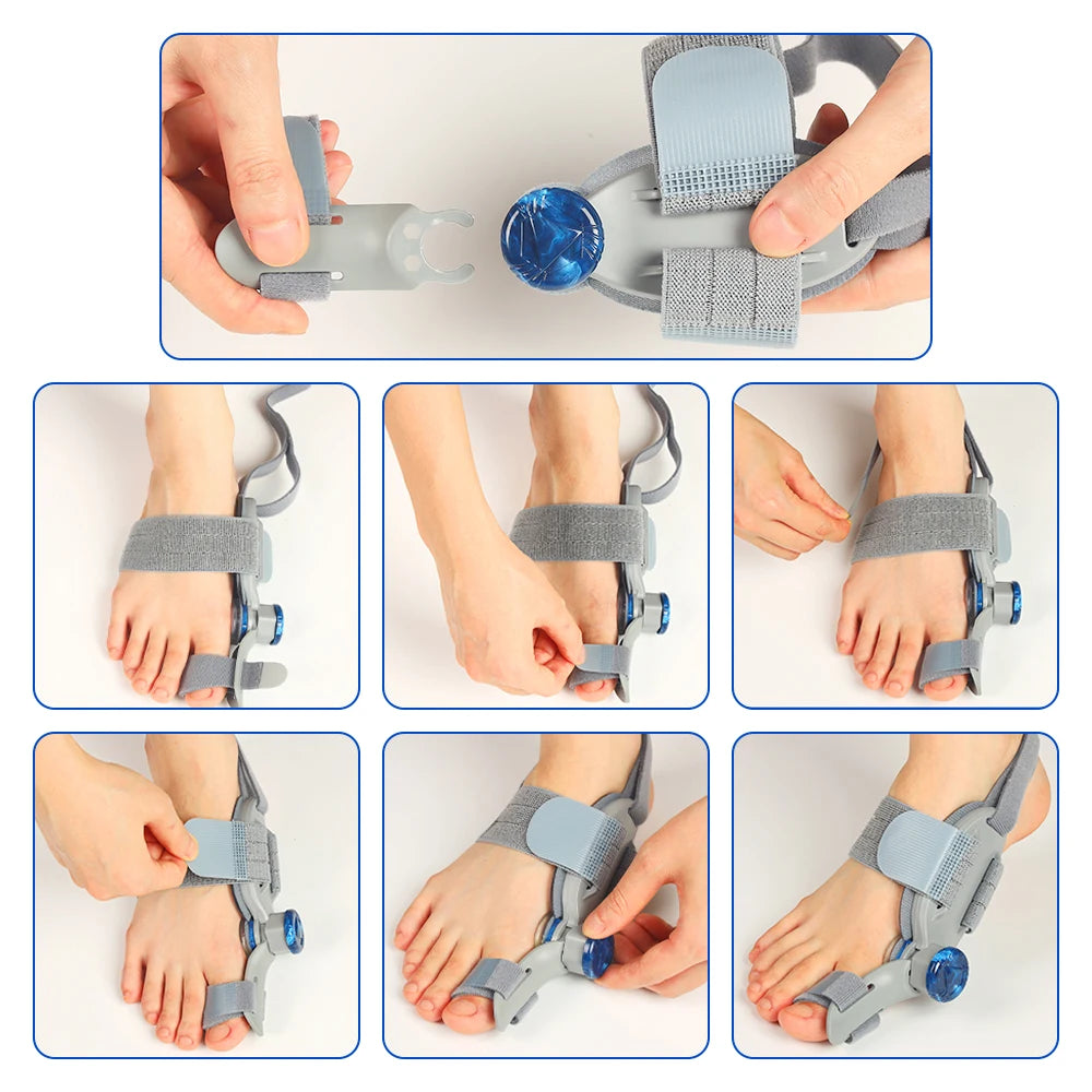 Hailicare Adjustable Bunion Corrector For Hallux Valgus Braces