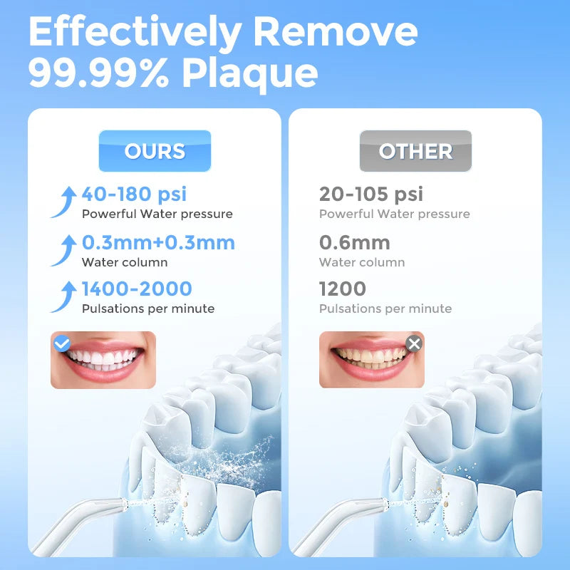 Sejoy Portable Electric Water Flosser Irrigator With Five Modes