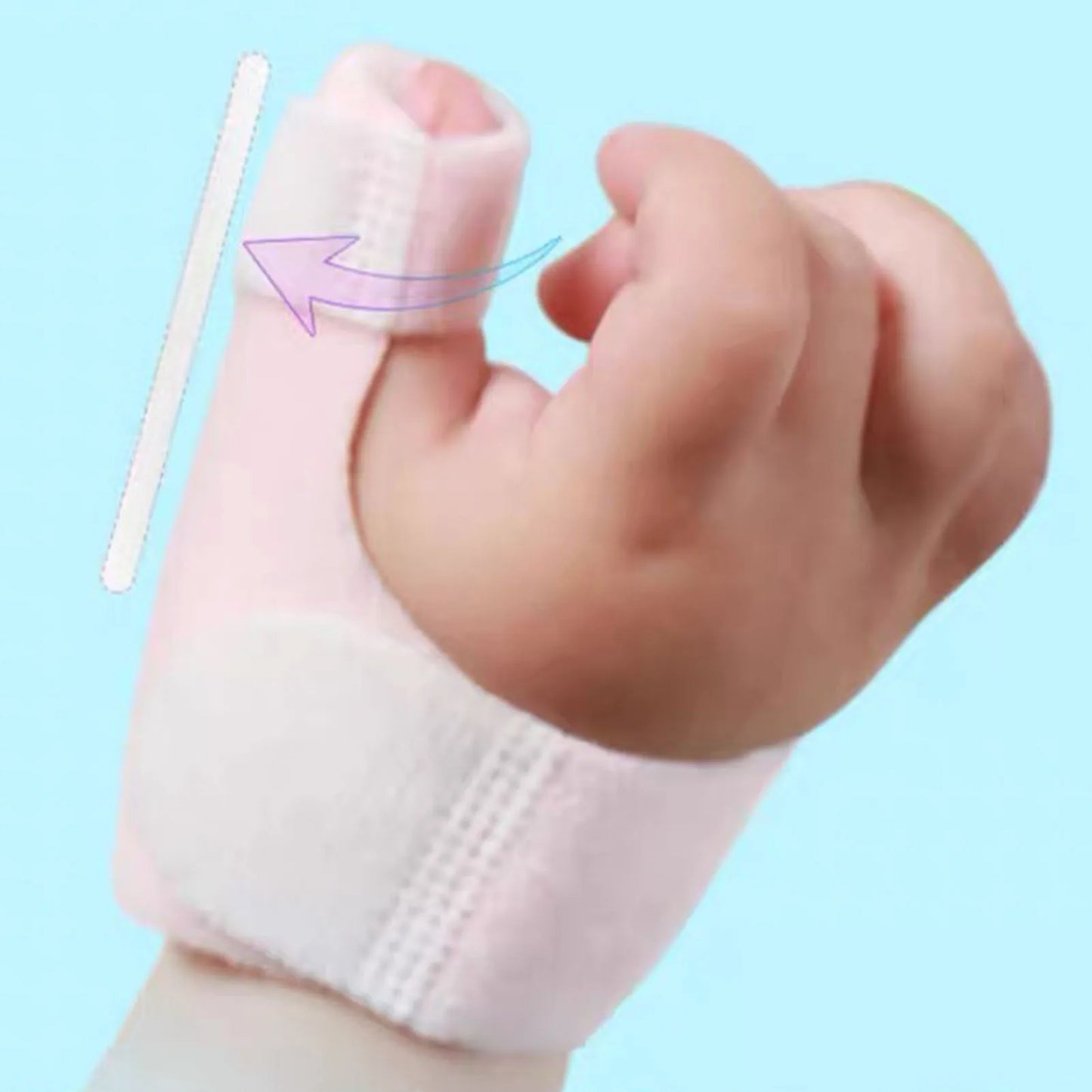 TMISHION Baby Thumb Finger Splint Soft Adjustable Fracture Support